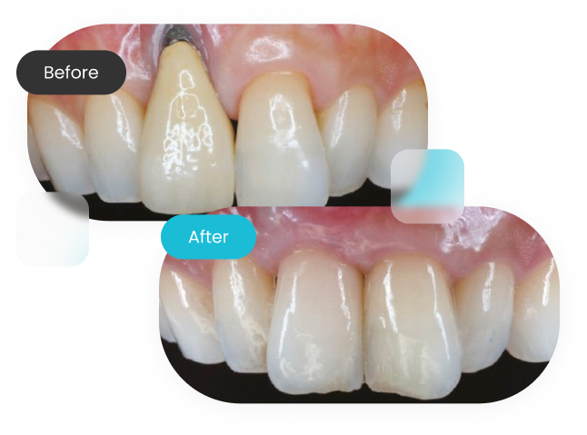 Transform Your Smile With Affordable Quality Care