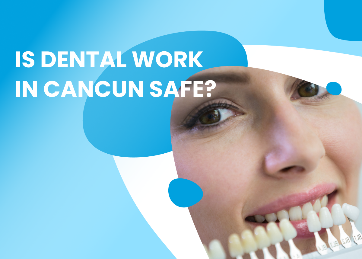 Dental Implants in Mexico vs USA