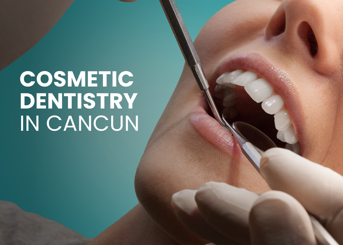 Cosmetic_Dentistry_in_Cancun__Achieve_Your_Dream_Smile_for_Less Dental Implants in Mexico vs USA