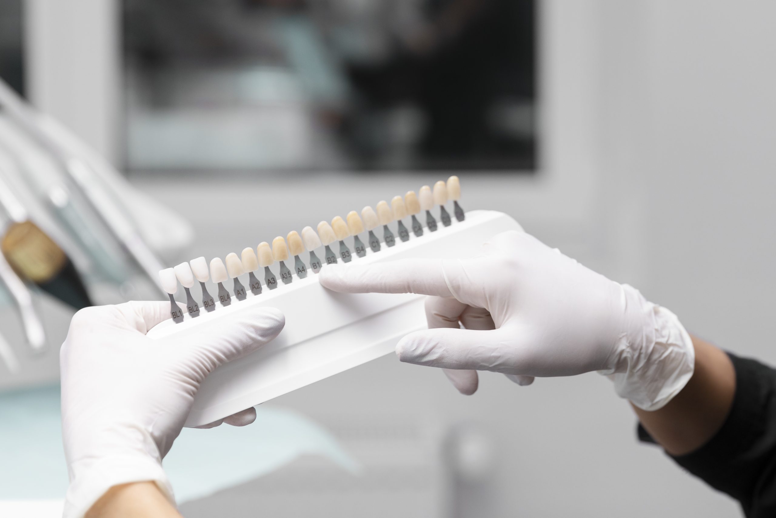 Veneers vs Crowns – Cancun Dental Clinic Dental Implants in Mexico vs USA