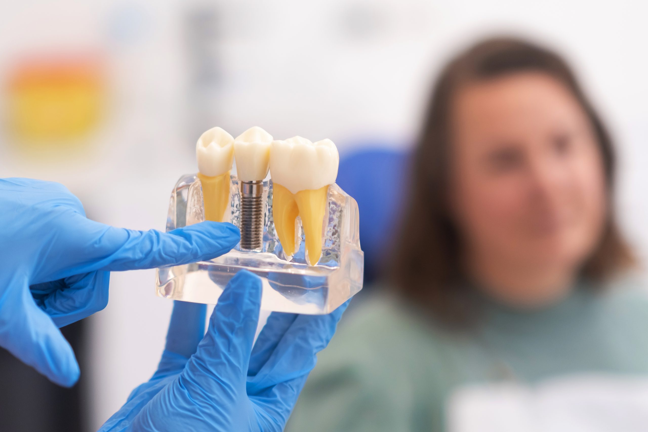 dental implants, dentist discussing a treatment plan with patient holds a dental implant model Dental Implants in Mexico vs USA