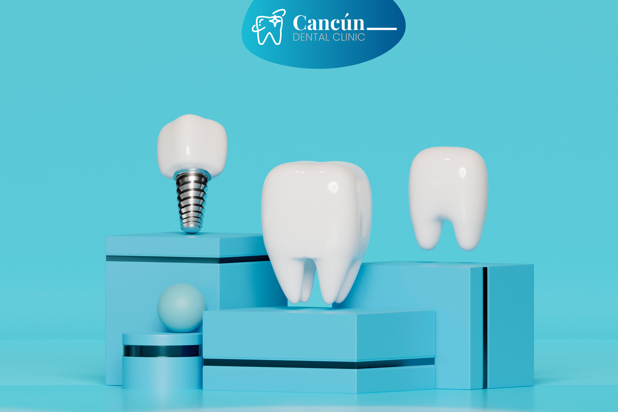 Diseño para Blog – Same day dental implants Dental Implants in Mexico vs USA